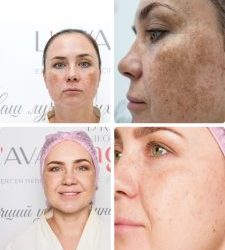 До и после — результаты